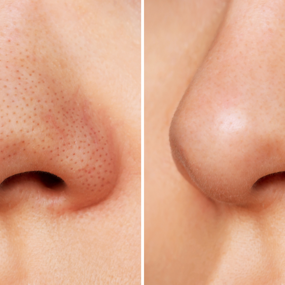 Antes y después de Sofía