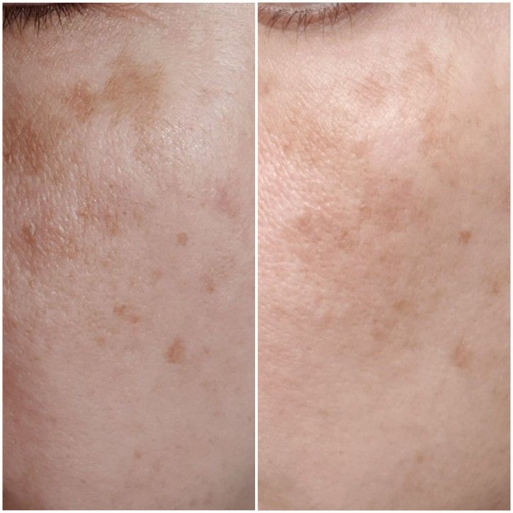 Antes y después de Diana