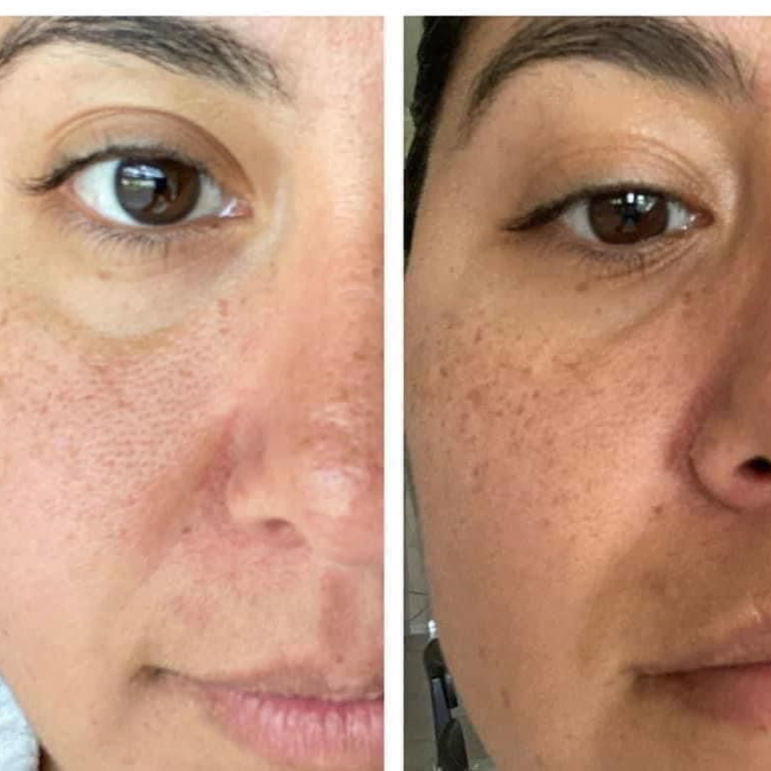 Antes y después de Camila