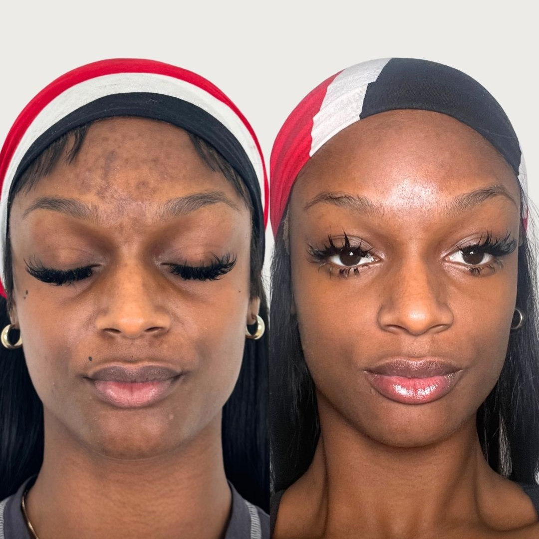 Antes y después de Paula