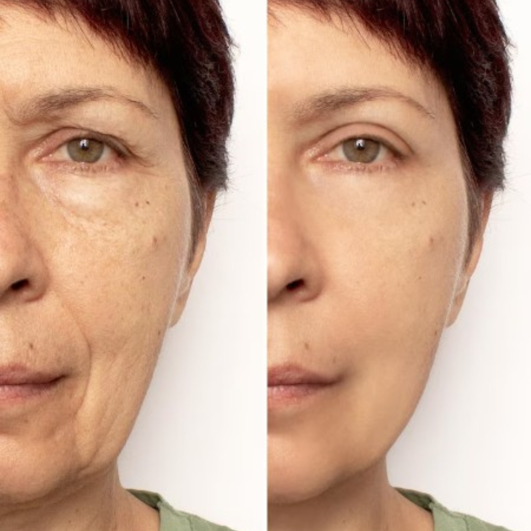 Antes y después de Andrea